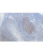 VCAM-1/CD106 Monoclonal antibody proteintech 66294-1-Ig