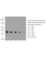 PCNA Monoclonal antibody proteintech 60097-1-Ig