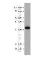 CD8a Monoclonal antibody proteintech 66868-1-Ig