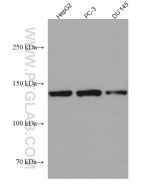 gp130/IL6ST Monoclonal antibody proteintech 67766-1-Ig