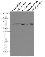 ETV5 Monoclonal antibody proteintech 66657-1-Ig