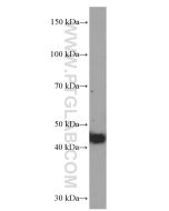 FUT9 Monoclonal antibody proteintech 60230-1-Ig