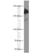SALL4 Monoclonal antibody proteintech 66236-1-Ig