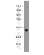 IL-17D Monoclonal antibody proteintech 66143-1-Ig