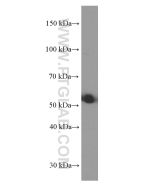 SRPX2 Monoclonal antibody proteintech 66266-1-Ig