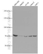 ABCD3 Monoclonal antibody proteintech 66697-1-Ig