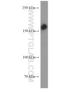CD109 Monoclonal antibody proteintech 60179-1-Ig