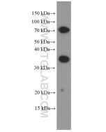 TIM3 Monoclonal antibody proteintech 60355-1-Ig