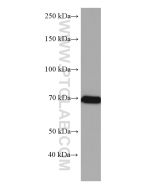 CDC25B Monoclonal antibody proteintech 67145-1-Ig