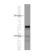 DCC-Specific Monoclonal antibody proteintech 67203-1-Ig