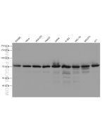 MTA2 Monoclonal antibody proteintech 66195-1-Ig