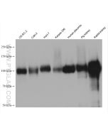 DPP4/CD26 Monoclonal antibody proteintech 68383-1-Ig