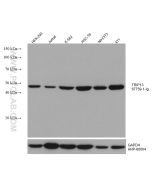 TRIP13 Monoclonal antibody proteintech 67759-1-Ig