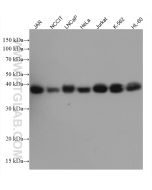 SIRT6 Monoclonal antibody proteintech 67510-1-Ig
