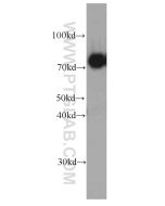 CPT1C Monoclonal antibody proteintech 66072-1-Ig