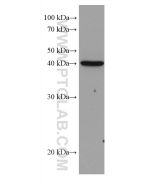 DHODH Monoclonal antibody proteintech 67977-1-Ig