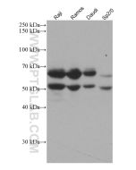 IKZF1 Monoclonal antibody proteintech 66966-1-Ig