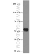 CHRNA5 Monoclonal antibody proteintech 66363-1-Ig