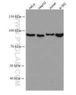 Importin Beta Monoclonal antibody proteintech 67597-1-Ig