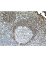 CCR6 Monoclonal antibody proteintech 66801-1-Ig