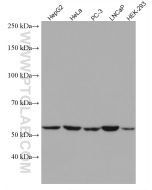 GPI Monoclonal antibody proteintech 67178-1-Ig
