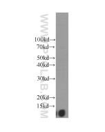 Beta-2-Microglobulin Monoclonal antibody proteintech 66207-1-Ig