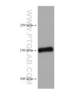 Entactin Monoclonal antibody proteintech 67310-1-Ig