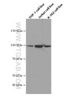 ADAM10 Monoclonal antibody proteintech 66620-1-Ig
