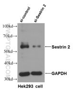 Sestrin 2 Monoclonal antibody proteintech 66297-1-Ig