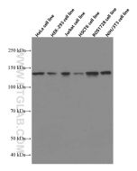 USP7 Monoclonal antibody proteintech 66514-1-Ig