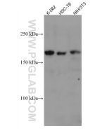 ZEB2 Monoclonal antibody proteintech 67514-1-Ig