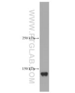 Ceruloplasmin Monoclonal antibody proteintech 66156-1-Ig