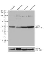 TNFR1/CD120a Monoclonal antibody proteintech 60192-1-Ig