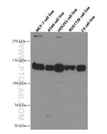IGF1R/CD221 Monoclonal antibody proteintech 66283-1-Ig