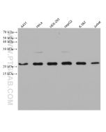 TOM22 Monoclonal antibody proteintech 66562-1-Ig