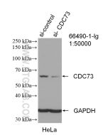 HRPT2, CDC73 Monoclonal antibody proteintech 66490-1-Ig