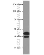 ACPP Monoclonal antibody proteintech 60176-1-Ig