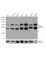 PPM1B Monoclonal antibody proteintech 67647-1-Ig