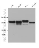 GP73/GOLPH2 Monoclonal antibody proteintech 66331-1-Ig