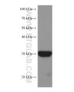BDH1 Monoclonal antibody proteintech 67448-1-Ig