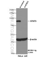 STAT3 Monoclonal antibody proteintech 60199-1-Ig