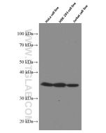 MDH1 Monoclonal antibody proteintech 66505-1-Ig