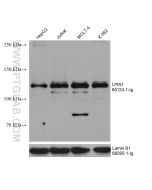 LPIN1 Monoclonal antibody proteintech 68124-1-Ig