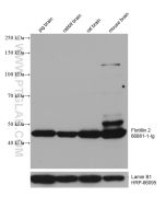 Flotillin 2 Monoclonal antibody proteintech 66881-1-Ig
