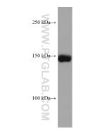 CPS1 Monoclonal antibody proteintech 67630-1-Ig