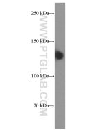 NCAM1/CD56 Monoclonal antibody proteintech 60238-1-Ig