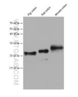 transgelin/SM22 Monoclonal antibody proteintech 60213-1-Ig