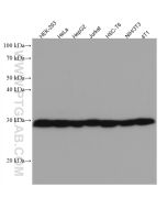 TMEM111 Monoclonal antibody proteintech 67205-1-Ig
