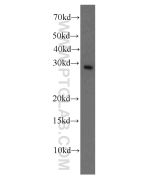 Factor XII Monoclonal antibody proteintech 66089-1-Ig
