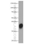 EPO/Erythropoietin Monoclonal antibody proteintech 66975-1-Ig